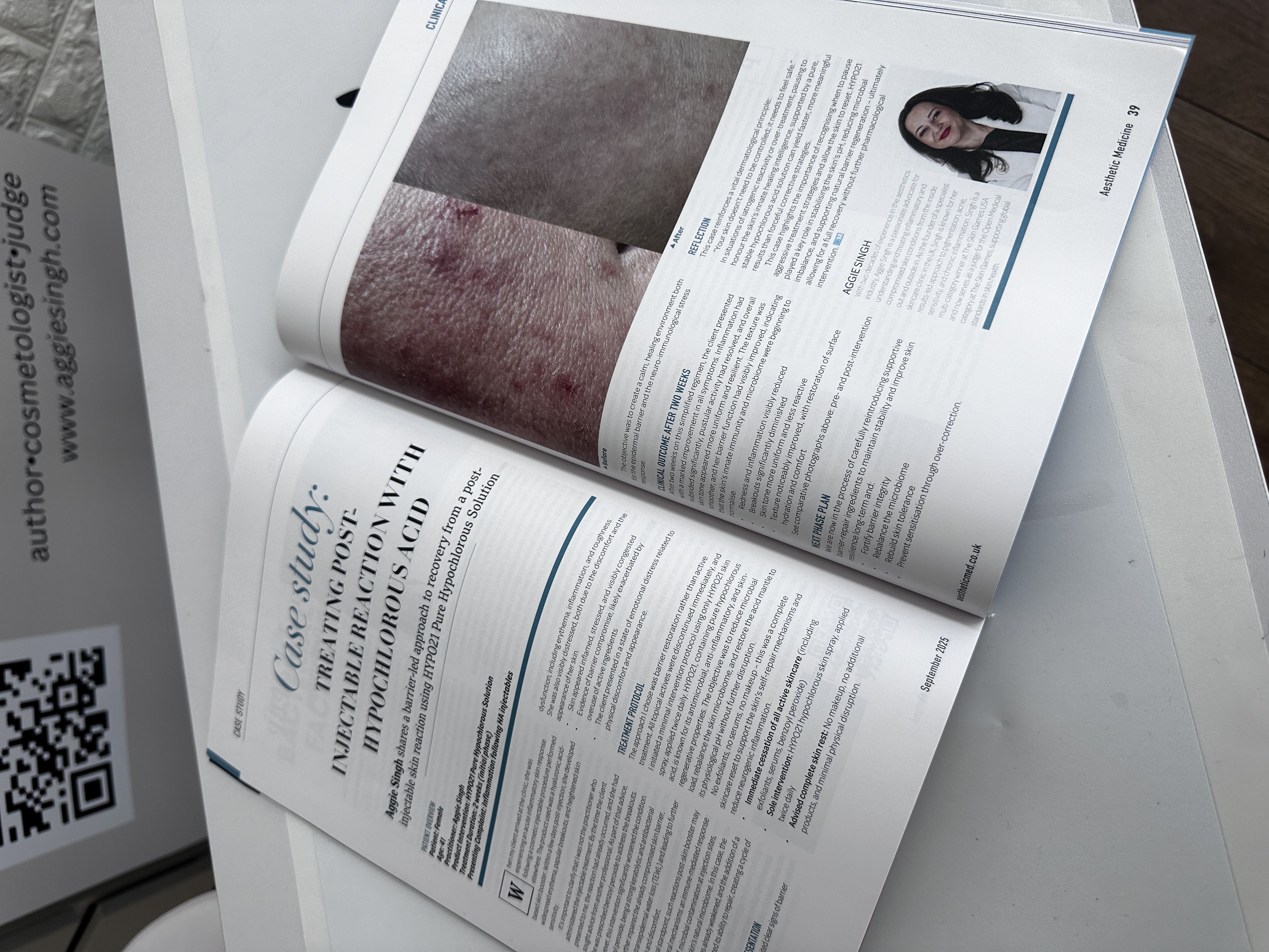 TREATING POST INJECTABLE REACTION with hypochlorous acid