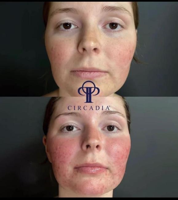 Kirsten Steward Beauty Therapy, work photo 3 of 6