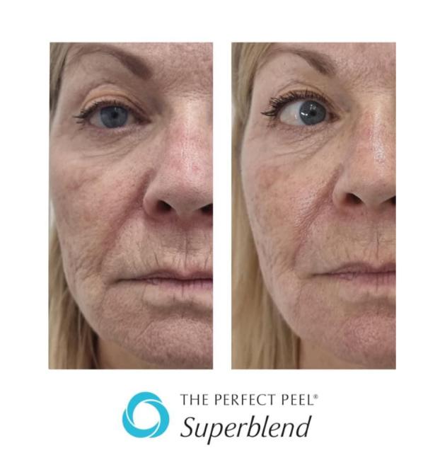 Kirsten Steward Beauty Therapy, work photo 5 of 6