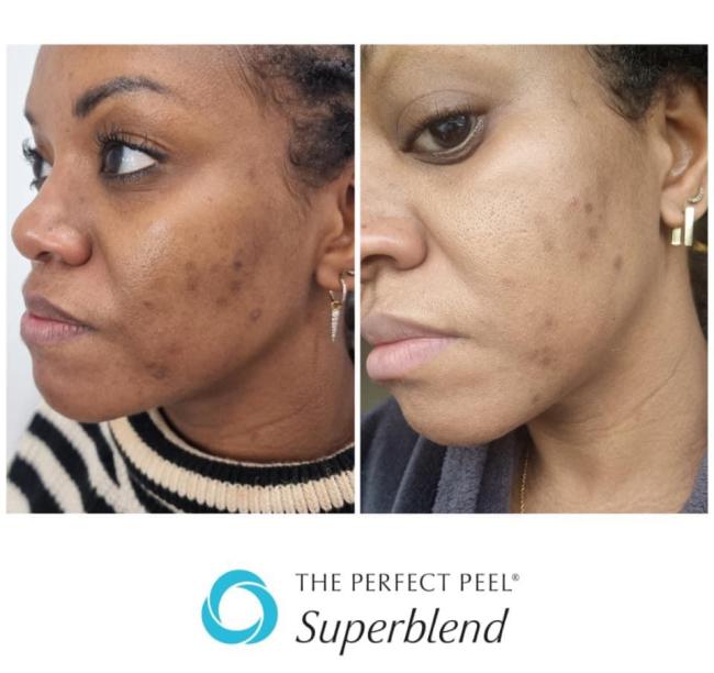 Kirsten Steward Beauty Therapy, work photo 4 of 6