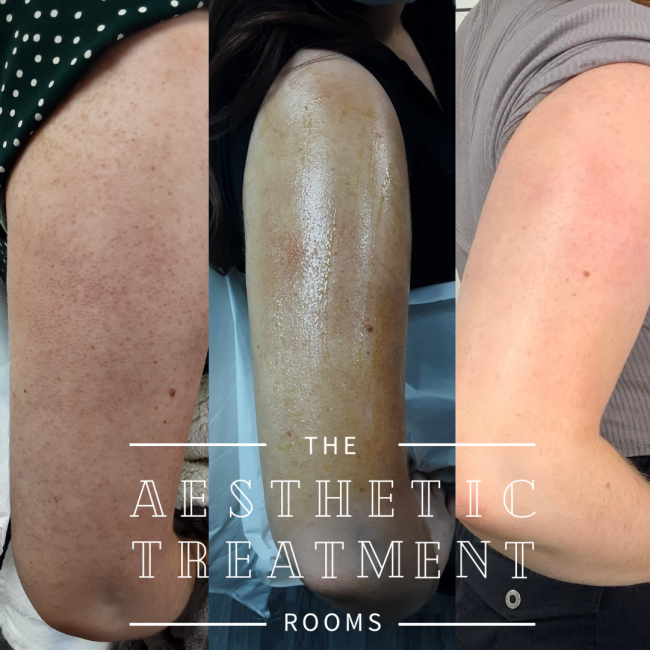 The Aesthetic Treatment Rooms, work photo 2 of 6