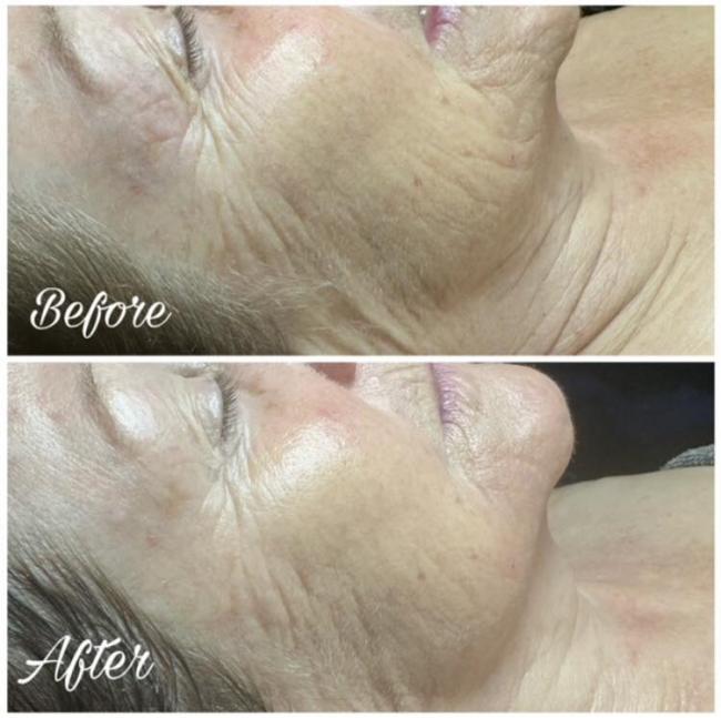 Sothy's illuminating & Flawless Facial for pigmentation and hydration