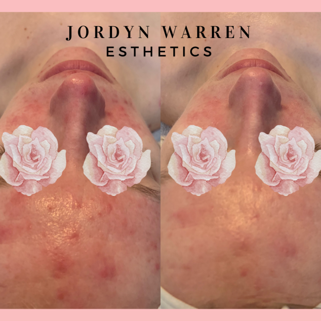 Jordyn Warren Esthetics, work photo 9 of 9
