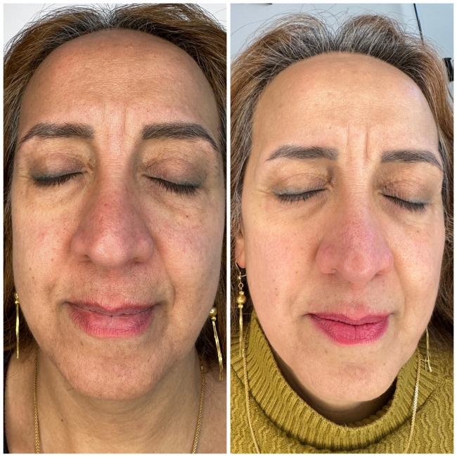 corrective skincare