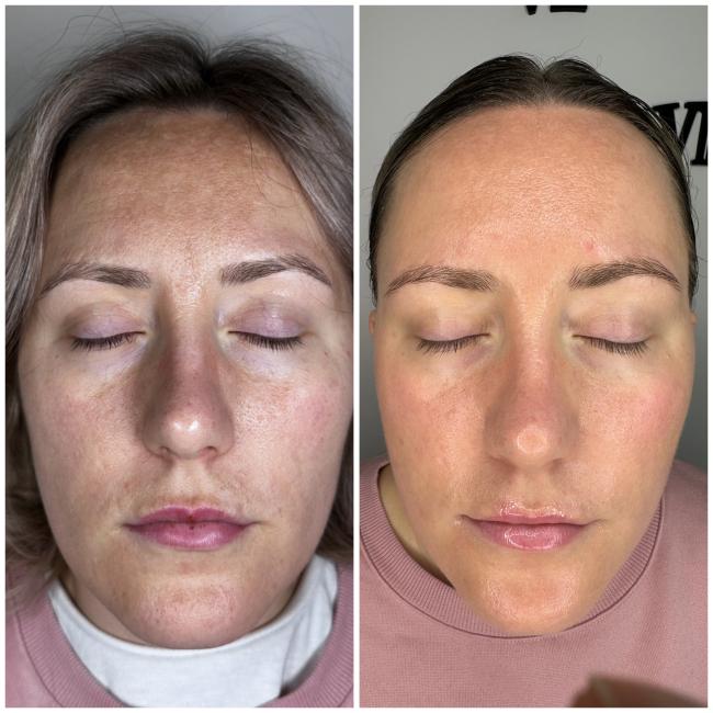 corrective skincare