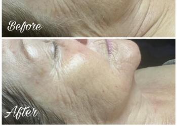 Sothy's illuminating & Flawless Facial for pigmentation and hydration
