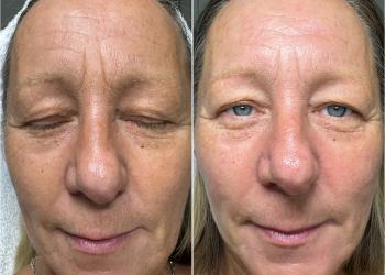 Zemits Hydroverstand