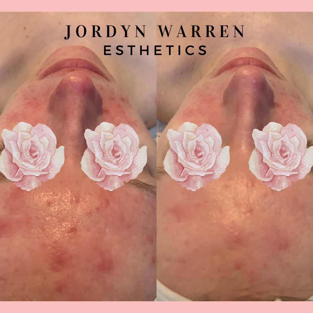 Jordyn Warren